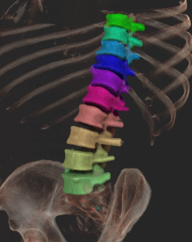 spine