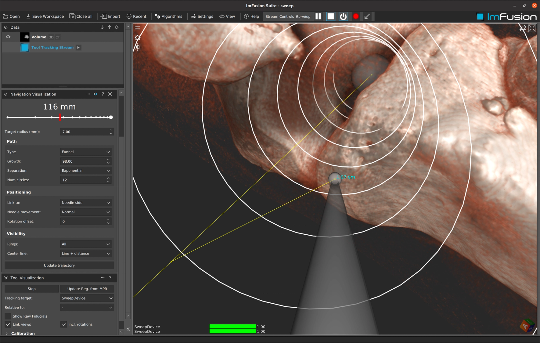 Tracked pointer aligned to a tool in a 3D navigation scene