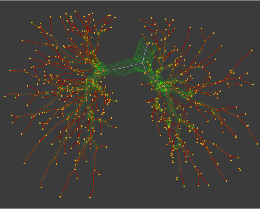 centerline representation of the bronchial tree