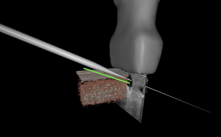 Surgical Navigation