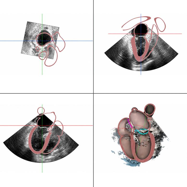 heart-image