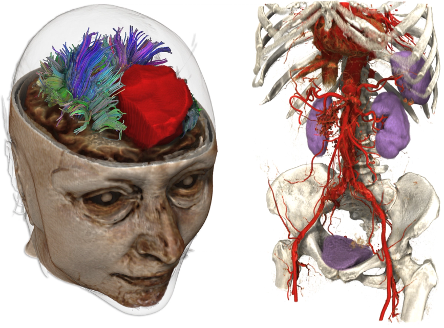 Anatomy