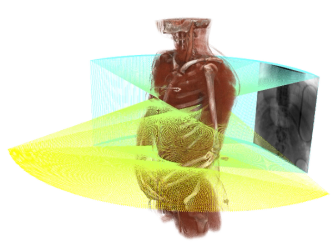 CT Reconstruction