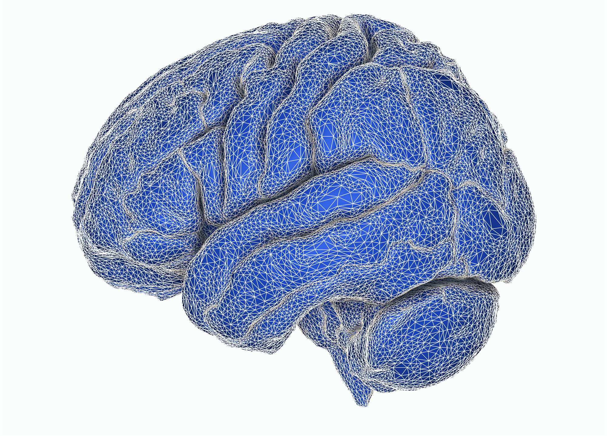 Color-coded whole-brain parcellation on T1-weighted MRI