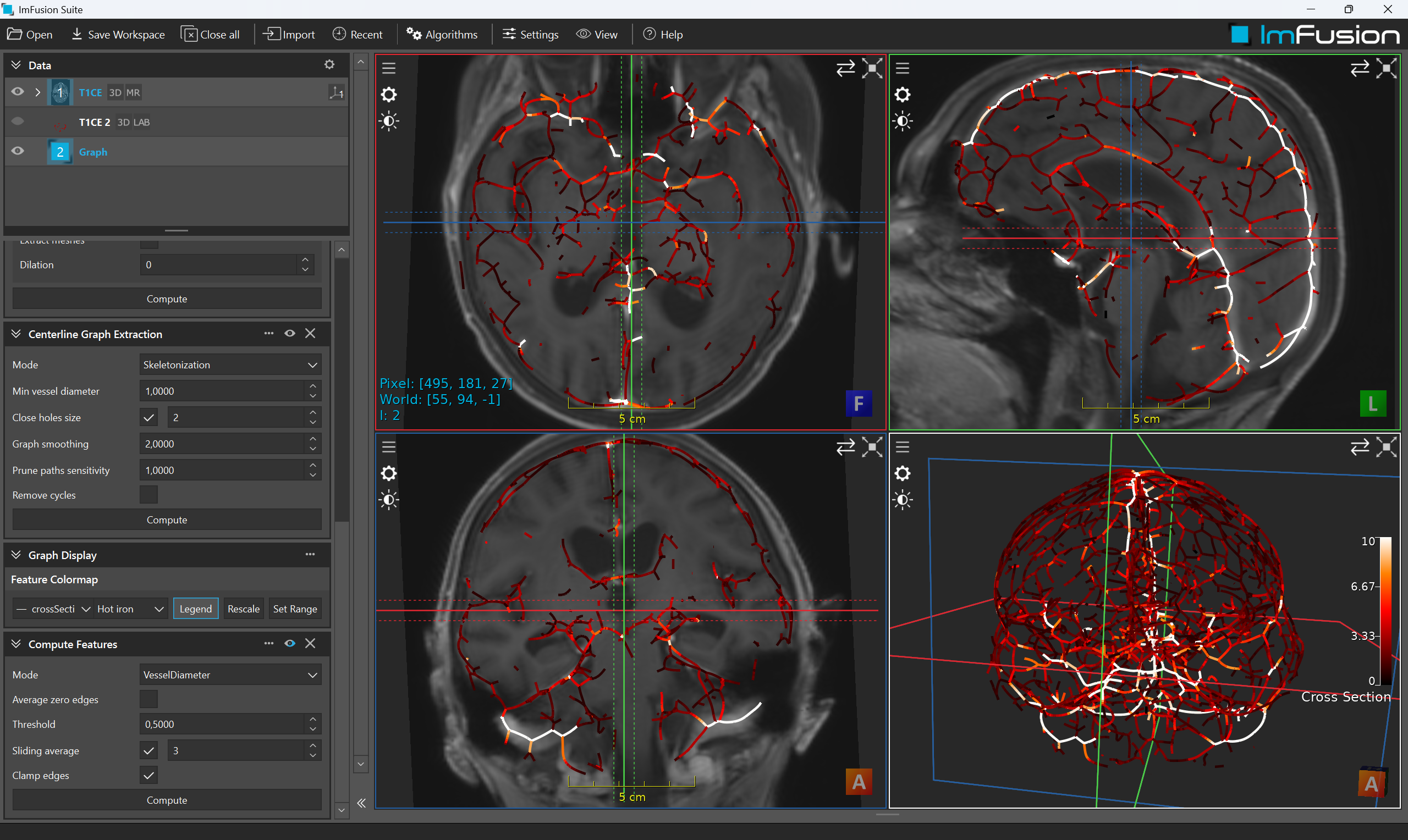 Cranial vessel graph from contrast-enhanced MRI