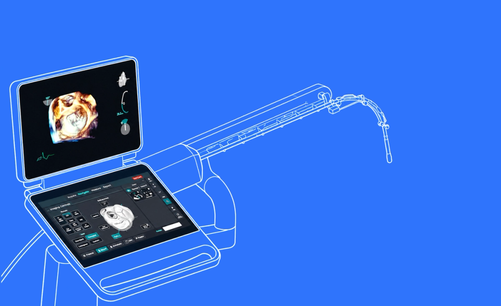 Guiding cardiac interventions with real-time heart models