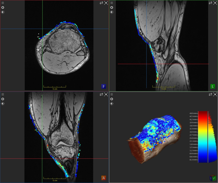 Surface-to-volume registration in ImFusion Computer Vision Suite