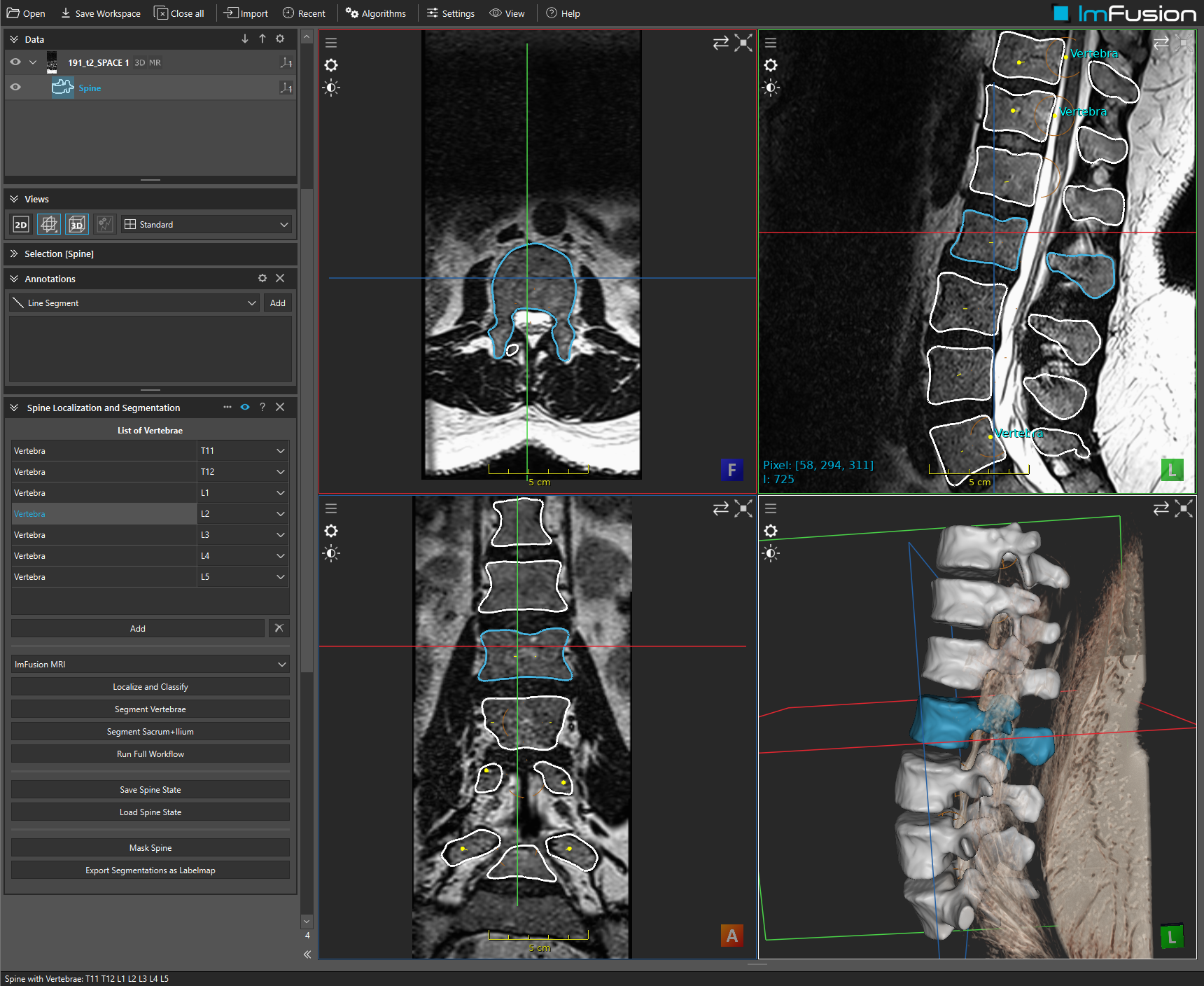 Spine project