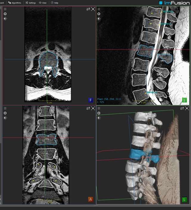 Spine project