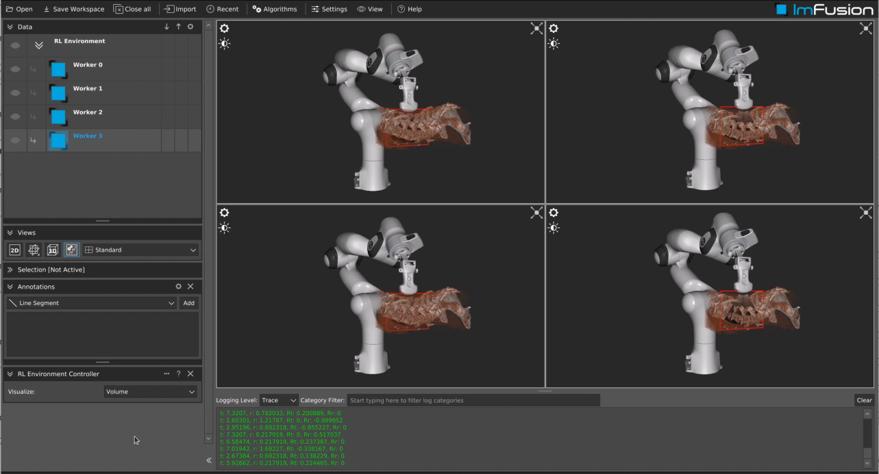 Intra-operative robotic ultrasound over a 3D spine volume