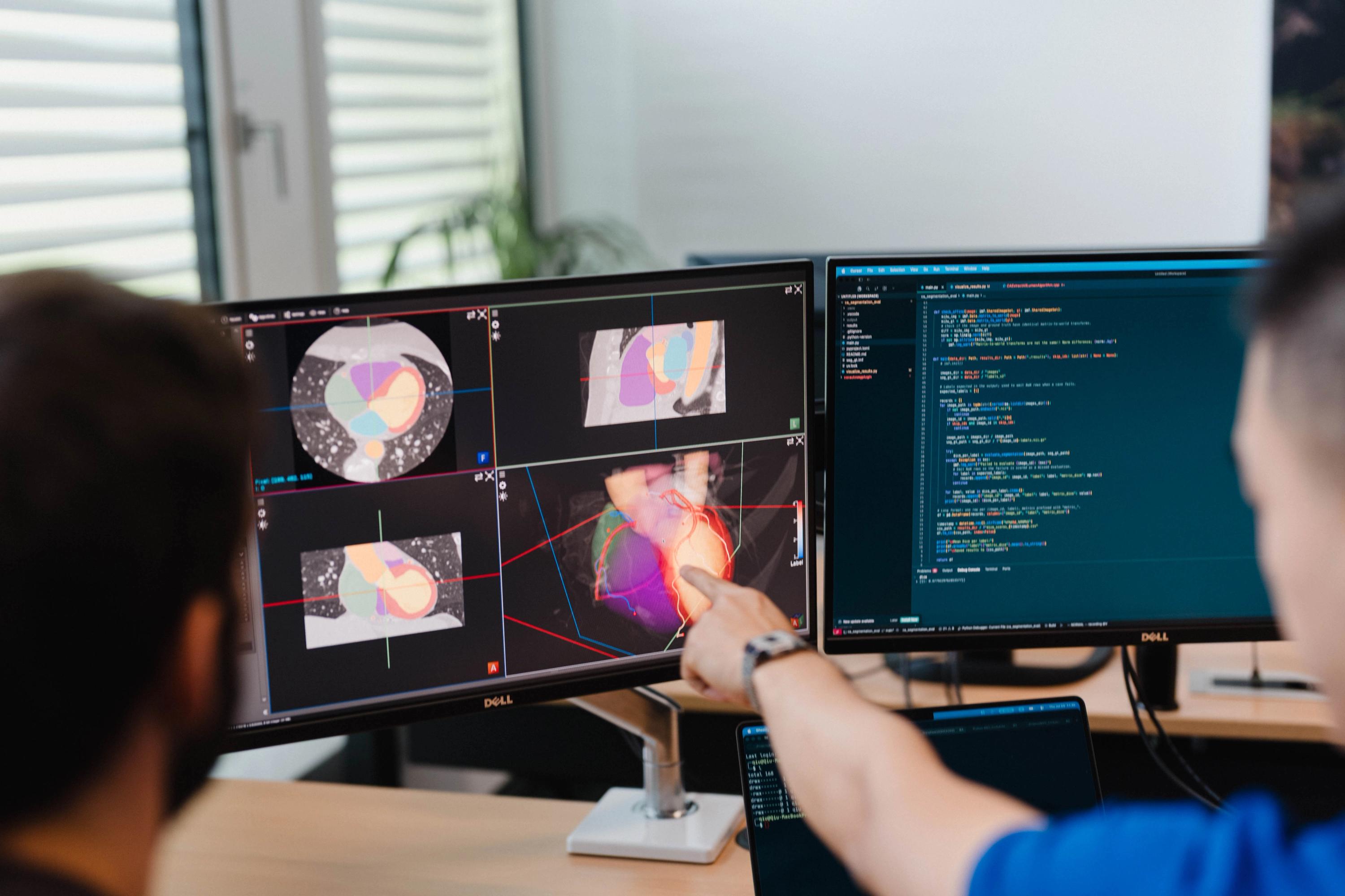 Two out of focus researchers in front of two screens, examining the ImFusion Suite and SDK