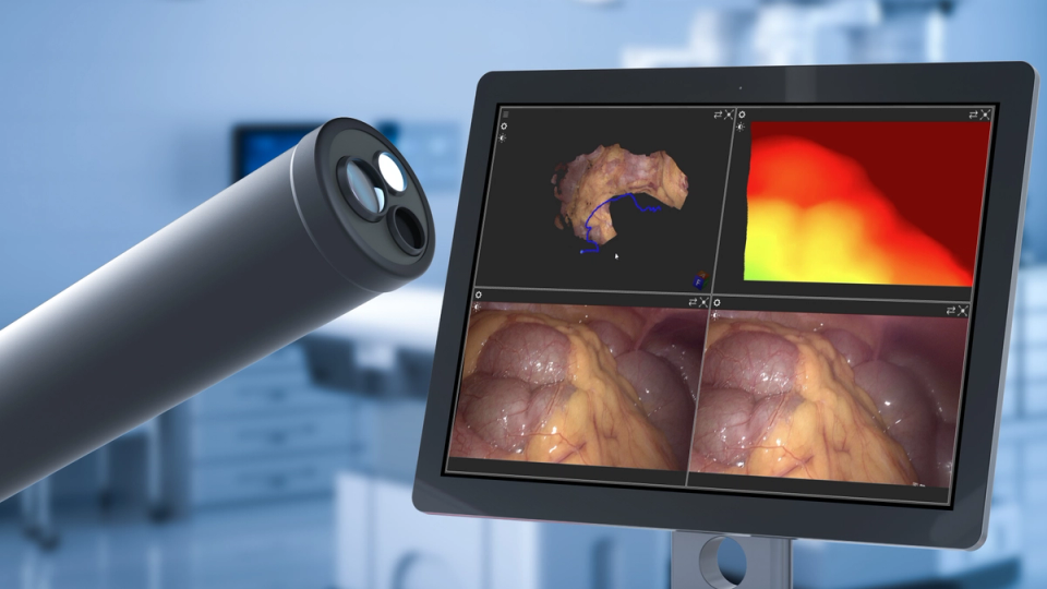 Endoscopic 3D reconstruction overlaid on a clinical vision scene