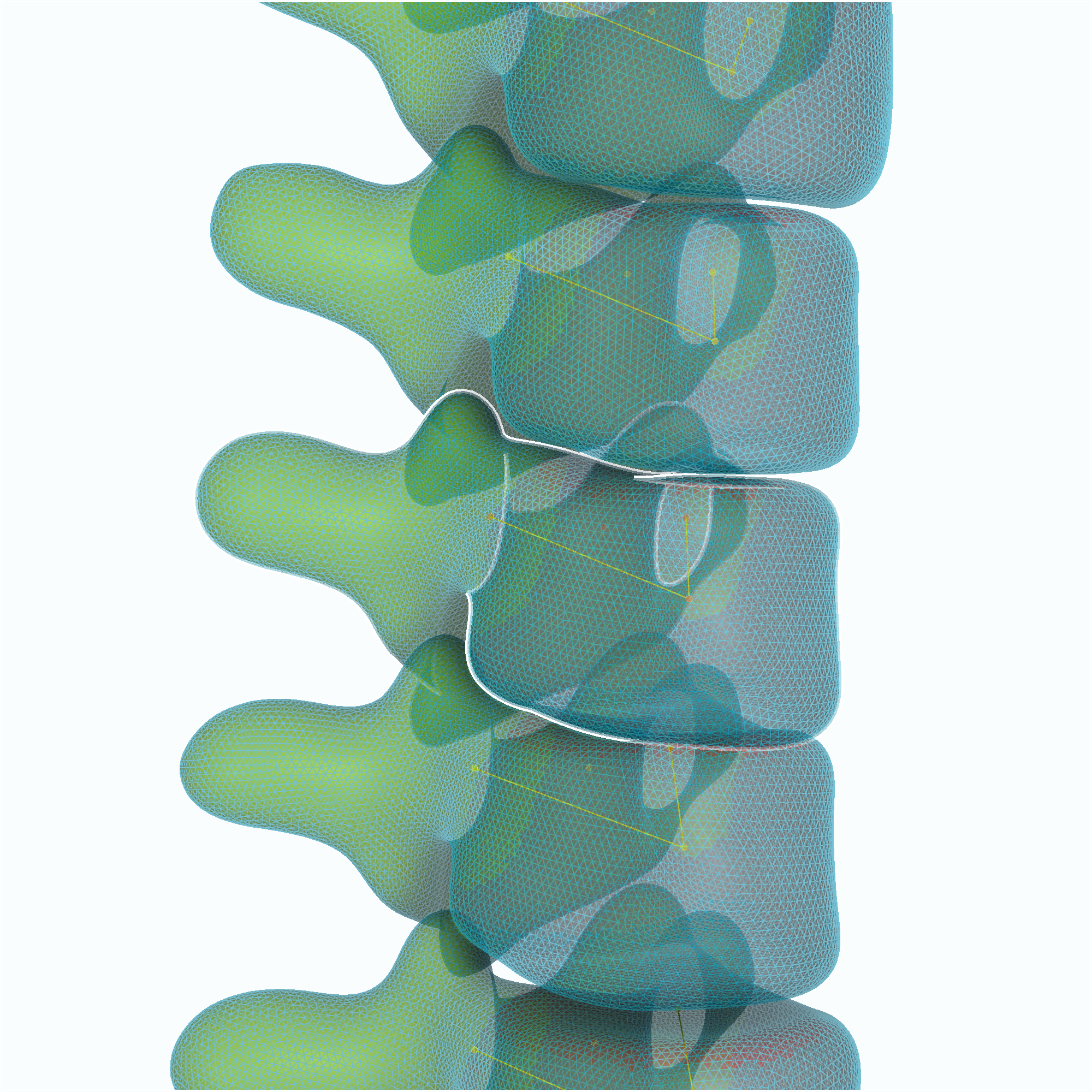 cad model of a spine template