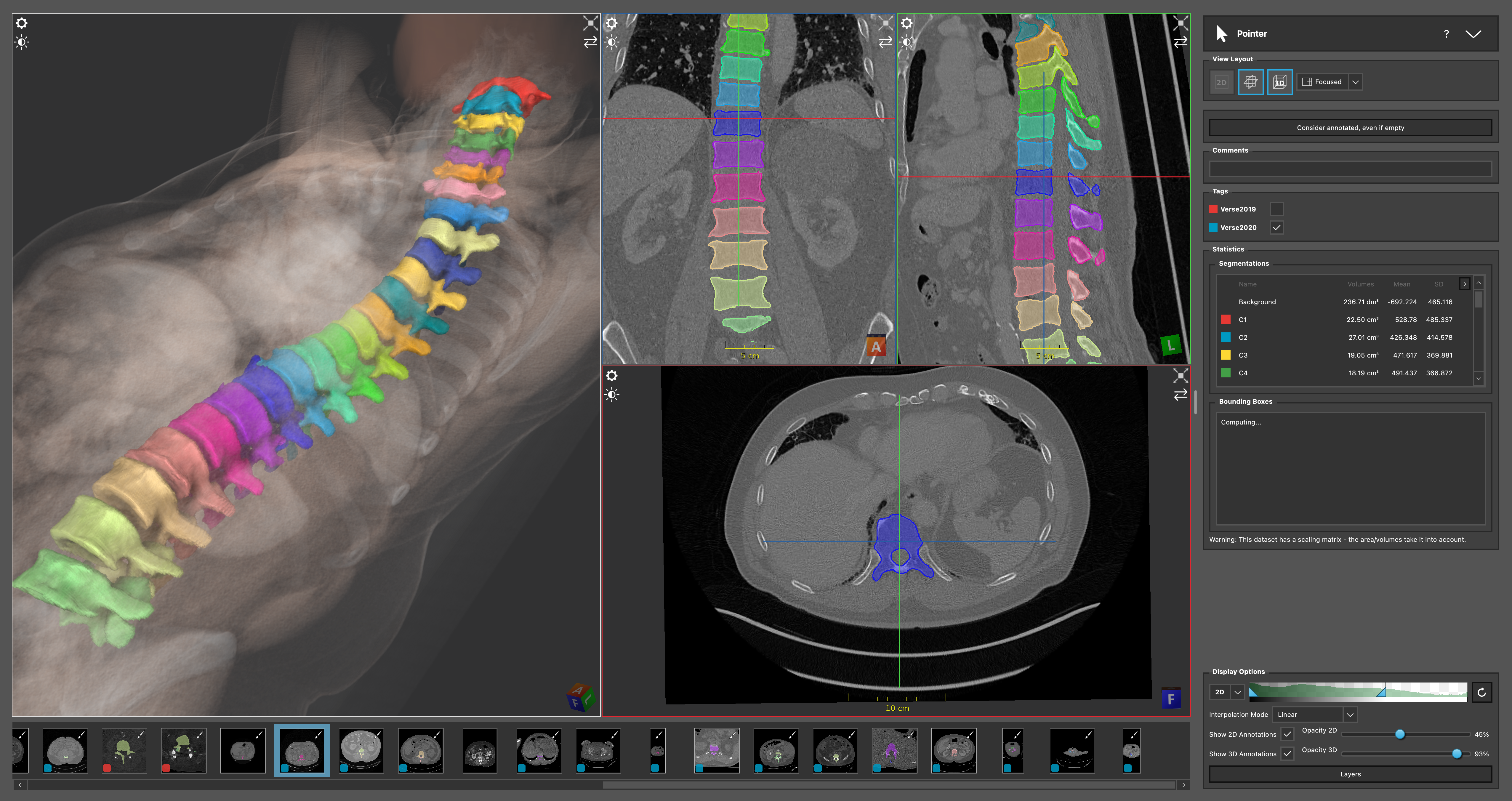 annotation view of imfusion label with volumetric segmentation of spine vertebra bodies