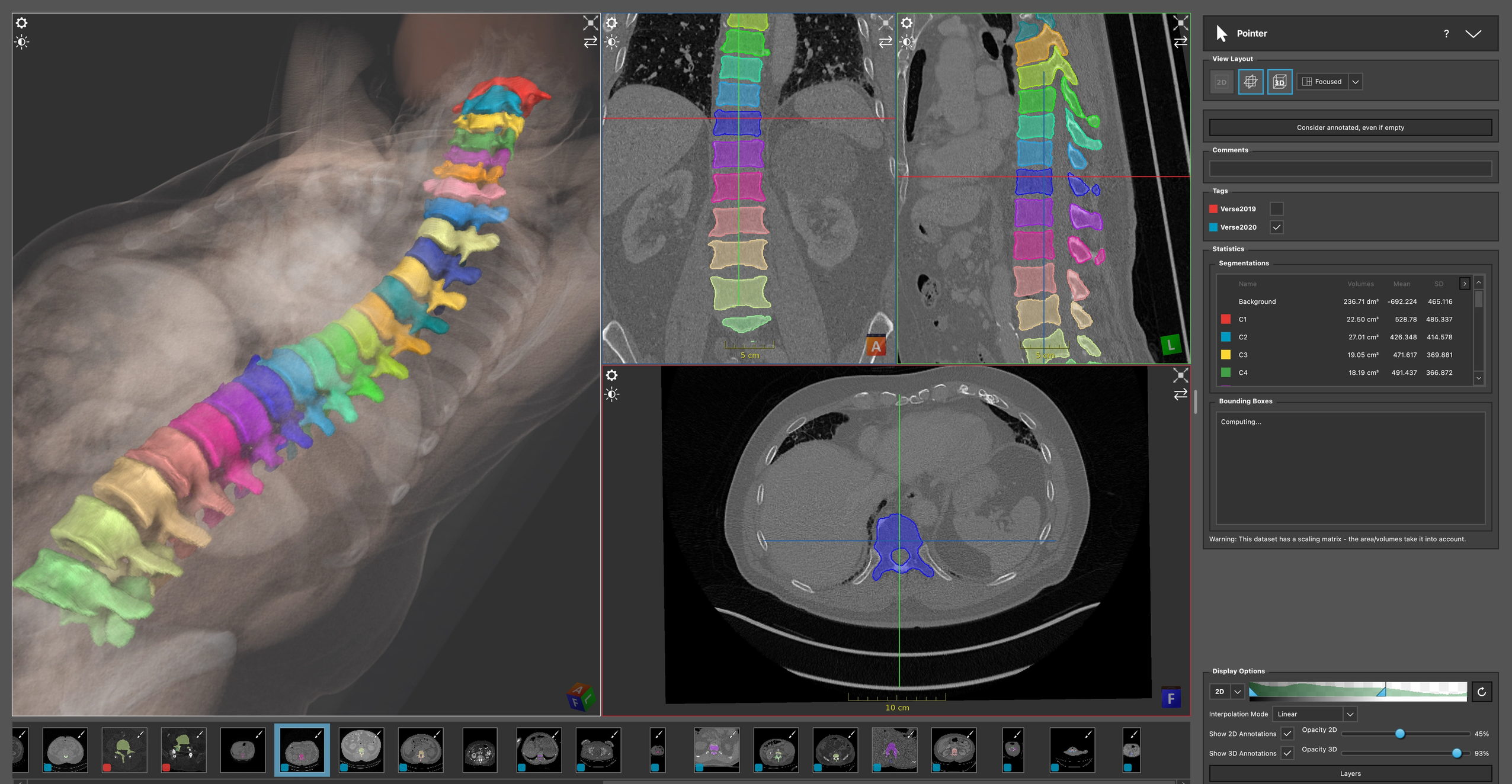 annotation view of imfusion label with volumetric segmentation of spine vertebra bodies