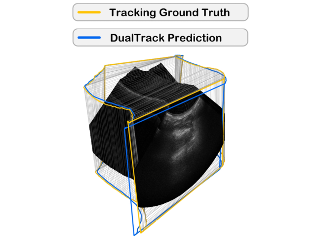 Ultrasound sweep images with a Tracking Ground Truth and Dual Track Prediction highlighted in yellow and blue, with minimal offset