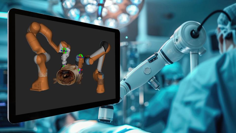 Robotic arm beside a 3D view of tracked robots over patient anatomy