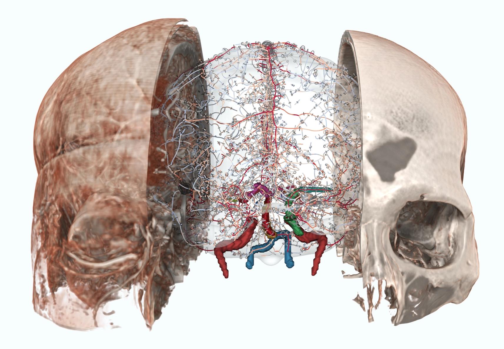 Whole-brain parcellation as named meshes