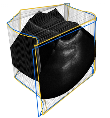 AI-based tracking estimation for freehand ultrasound reconstruction