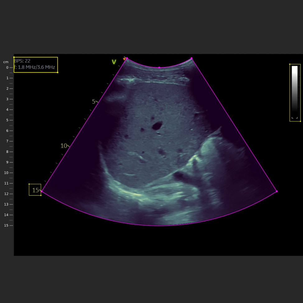 Live B-mode ultrasound frame with probe geometry and acquisition parameters
