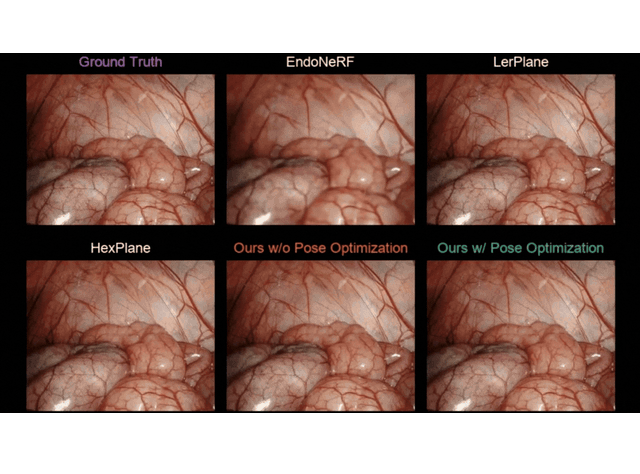 6 different endoscopic views with with different Radiance Fields Optimizations
