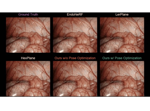 6 different endoscopic views with with different Radiance Fields Optimizations