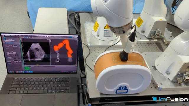 How our framework makes robotic ultrasound work out of the box.
