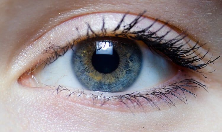 What Is Computer Vision Syndrome?