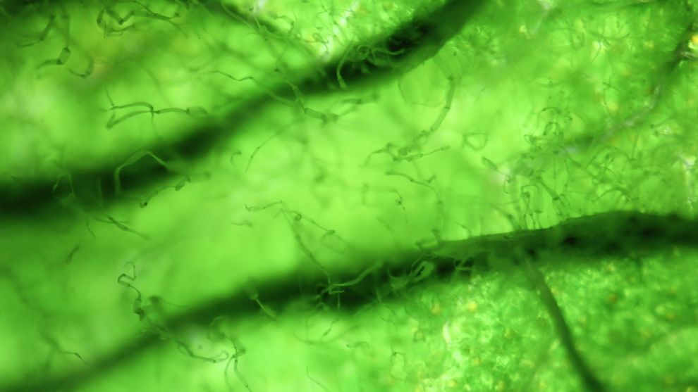 Microscope view of microalgae