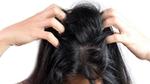 Lady with dark hair scratching head. Unilever research finds bacteria that causes dandruff.