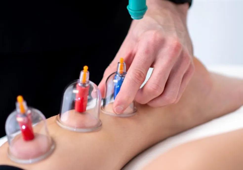 Cupping In Hallandale Beach at B3 Physical Therapy in Hallandale Beach