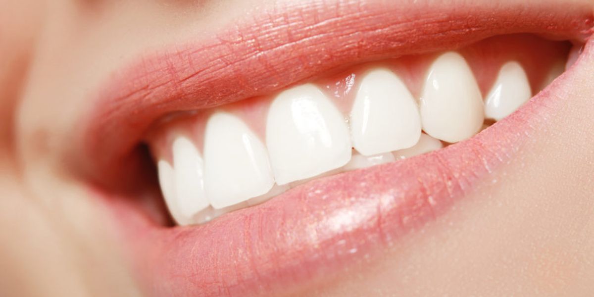 Choosing Between Invisalign and Braces: Which Option Is Faster?