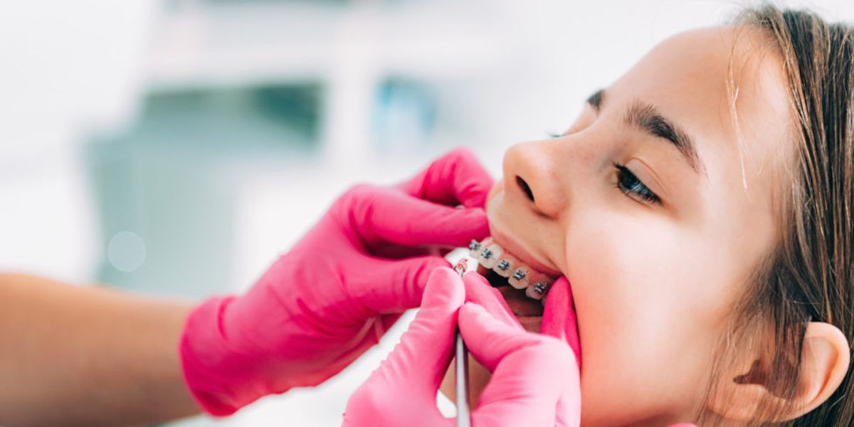 How to Choose an Orthodontist
