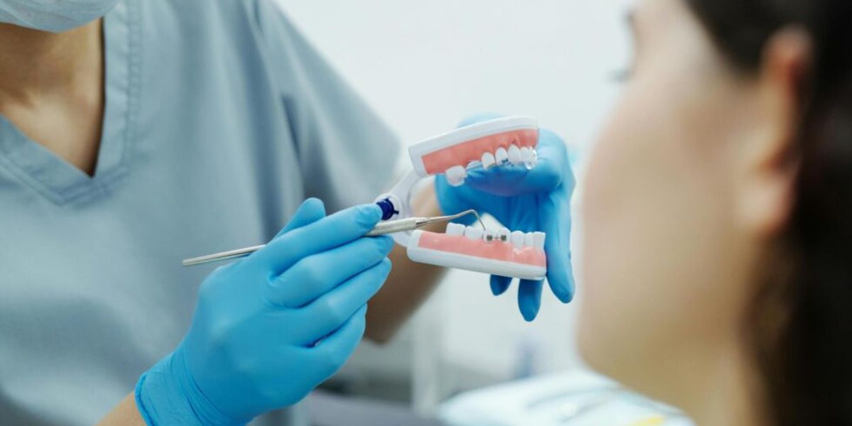 A Guide to the Best Braces for Adults