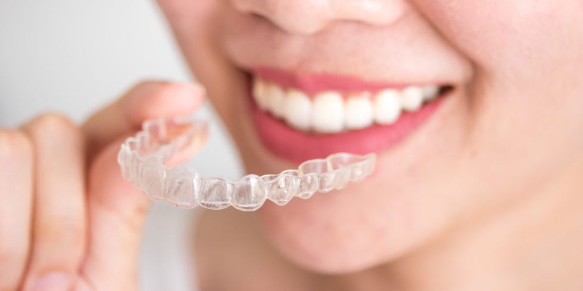 Braces vs Invisalign? Plus, What Is the Average Cost of Invisalign?
