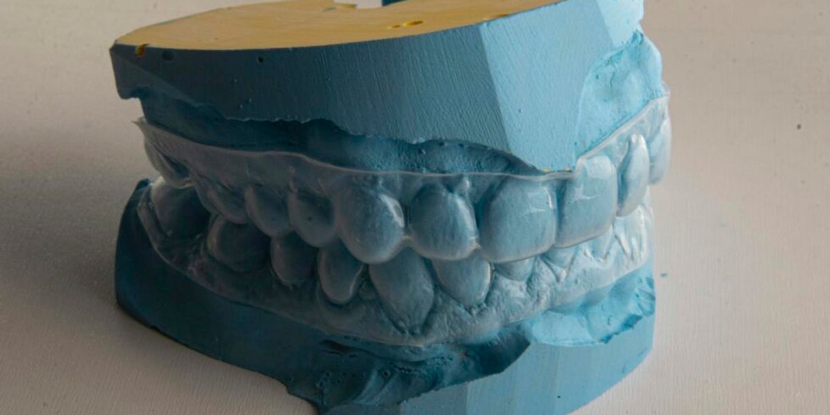 Is Invisalign Worth It for You? Benefits, Costs, and FAQs