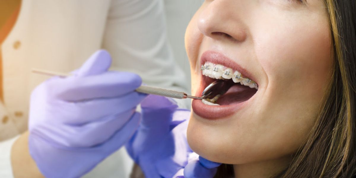 What to Consider When Choosing an Orthodontist in Lexington