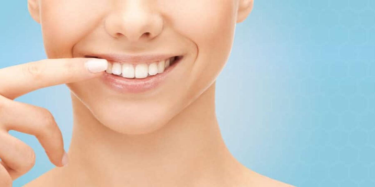 What Are Your Options for Smile Correction?