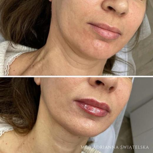 Metamorfoza przed i po — 68