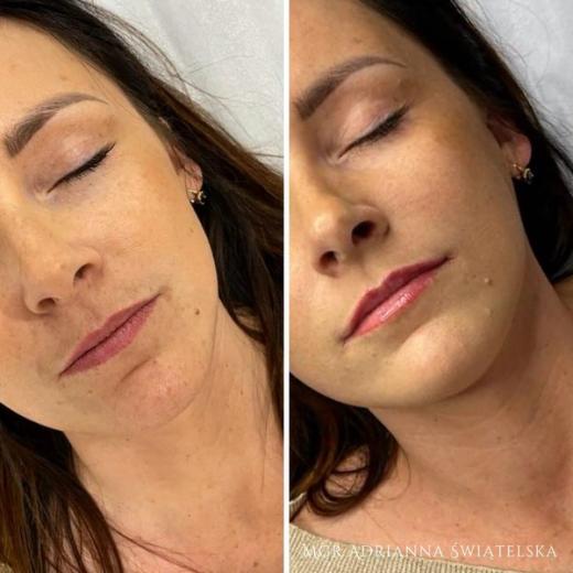 Metamorfoza przed i po — 22
