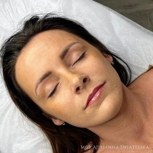 Metamorfoza przed i po — 49