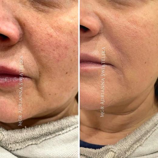 Metamorfoza przed i po — 36