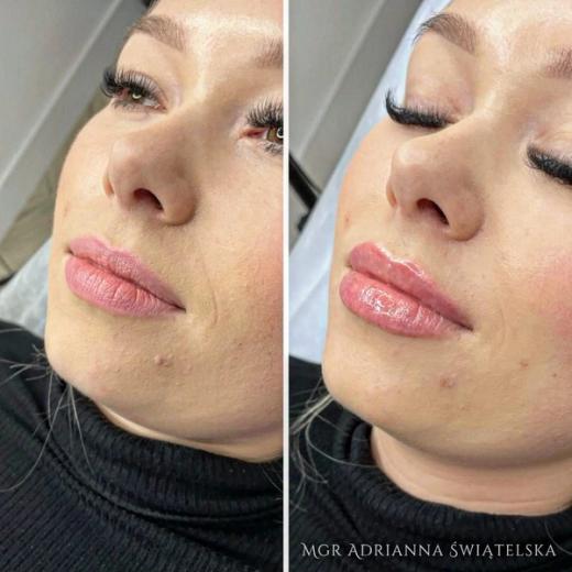 Metamorfoza przed i po — 52