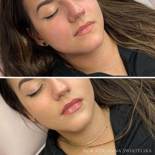 Metamorfoza przed i po — 70