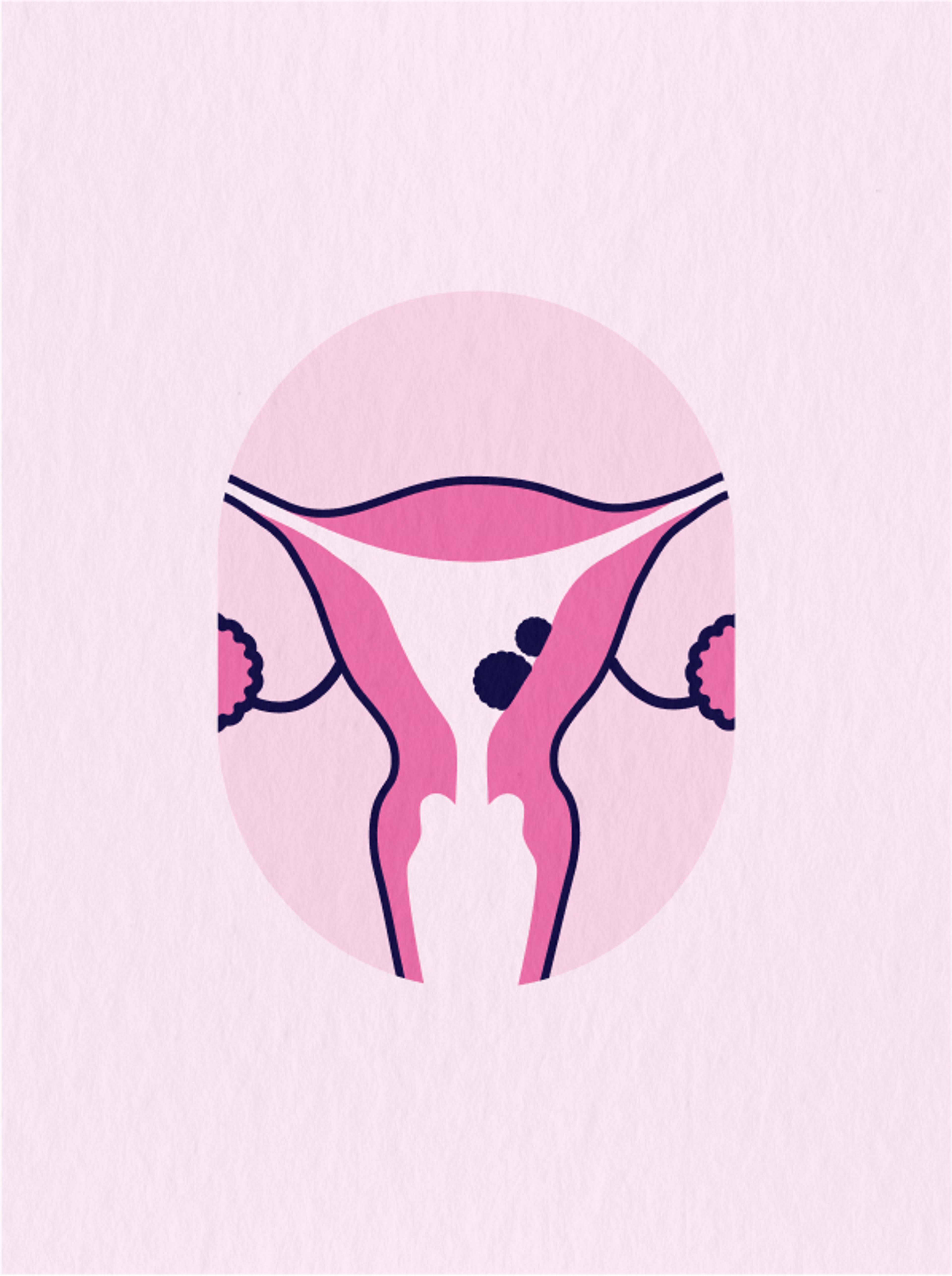 Für die Brustkrebshilfe eine Illustration von dem Uterus in einem modernen Stil in Pinktönen von Unerwartet Design