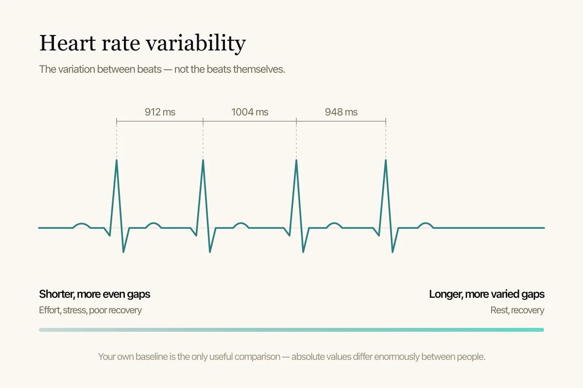 A diagram: an ECG trace with unequal gaps between beats labelled in milliseconds.