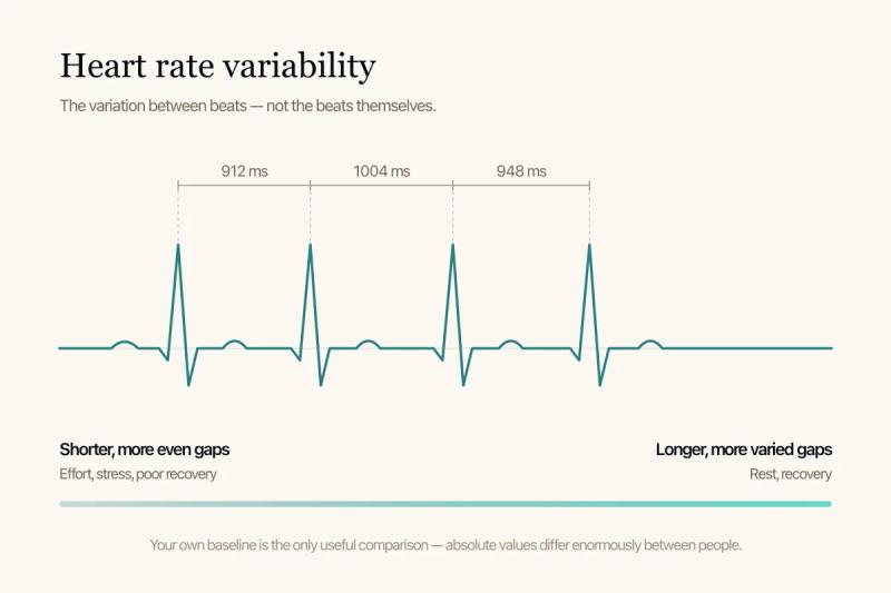 A diagram: an ECG trace with unequal gaps between beats labelled in milliseconds.