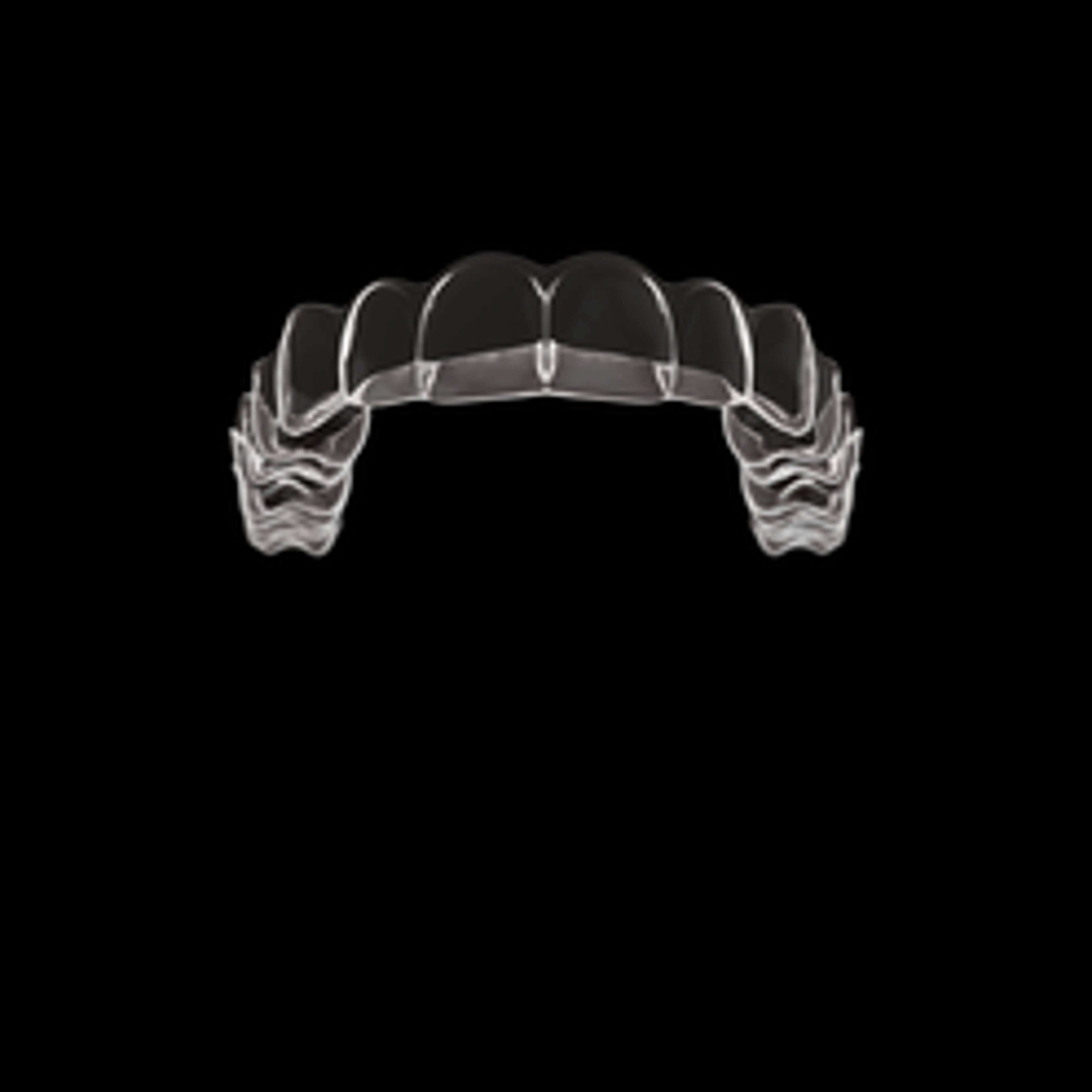 Durchsichtige Zahnspange (Aligner)