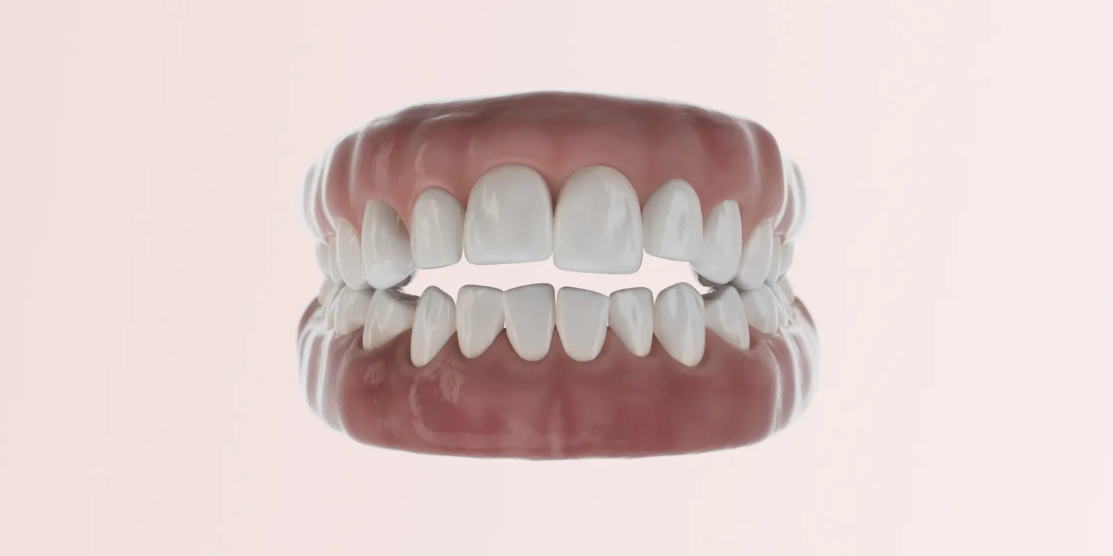 Offener Biss Header Bild