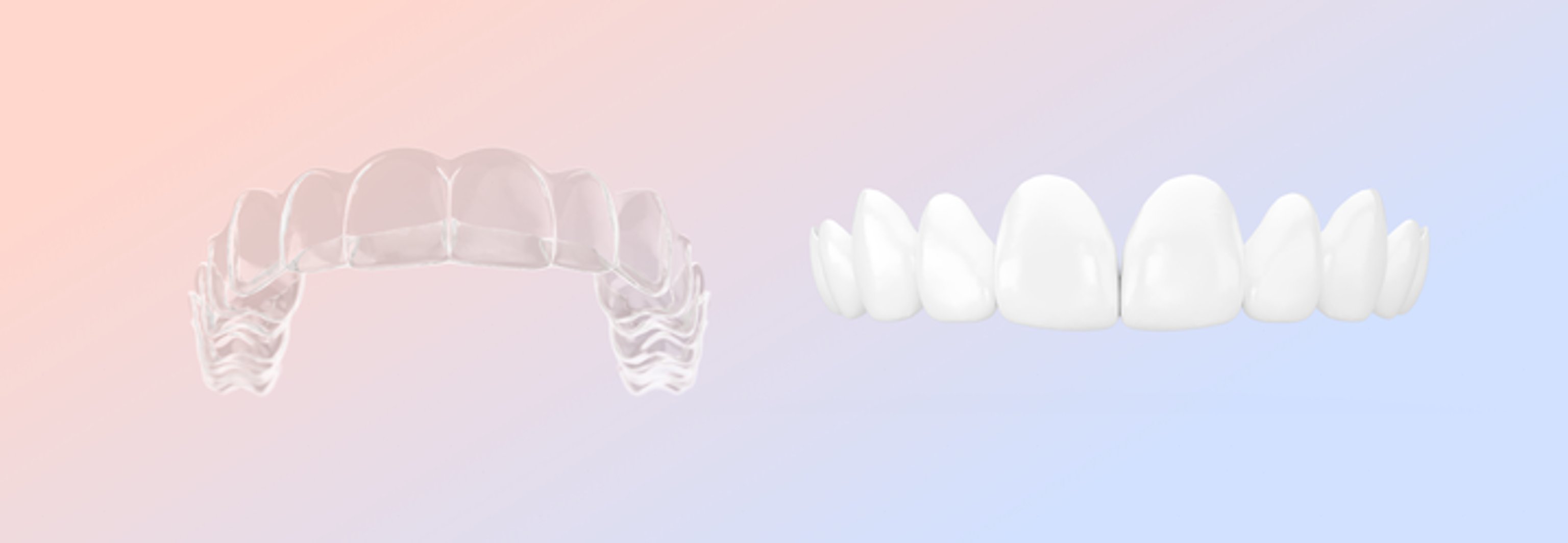 Aligner and veneers comparison